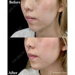 AI Beauty Clinic （エーアイ美容クリニック） 田中 里佳医師の症例