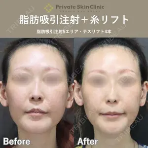 プライベートスキンクリニック 梅田本院 安形 省吾医師の症例