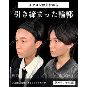 新宿美容外科ネビュラクリニック 山本 紘子医師の症例