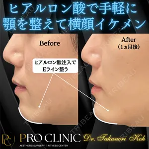 PRO CLINIC プロクリニック 銀座院 洪 嵩典医師の症例