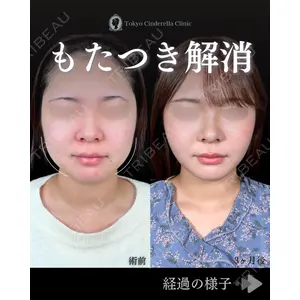 東京シンデレラ美容外科 池袋院 石井 達也医師の症例