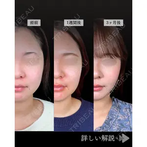 東京シンデレラ美容外科 池袋院 石井 達也医師の症例