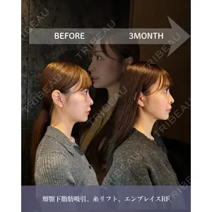 HAAB BEAUTY CLINIC 南青山本院（新院） 金子 雄医師の症例