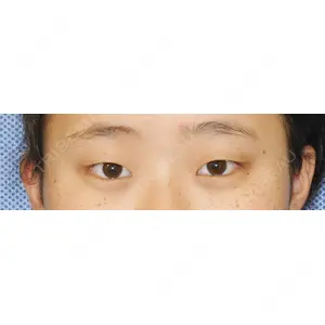 新宿美容外科クリニック 新宿院 井上 淳医師の症例