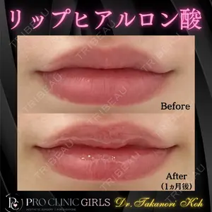 PRO CLINIC プロクリニック 銀座院 洪 嵩典医師の症例