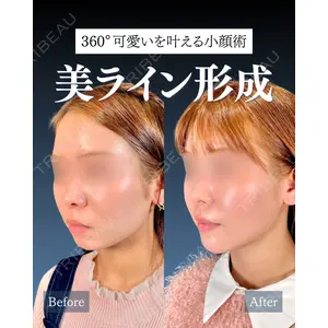 神戸美容外科 ネビュラクリニック 岩﨑 雅医師の症例