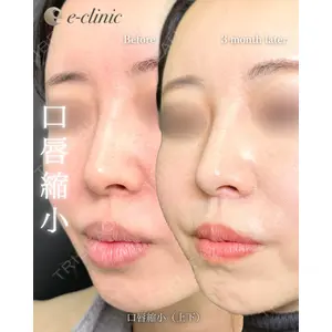 eクリニック 福岡院 伊藤 渉医師の症例