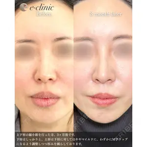 eクリニック 福岡院 伊藤 渉医師の症例