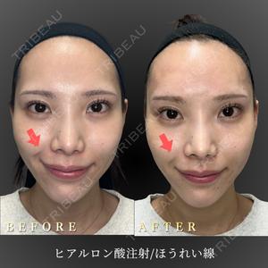 BiBiクリニック 山本 幸一郎医師の症例