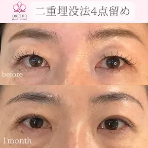 オーキッド美容クリニック東京御徒町 西浦 蘭子医師の症例