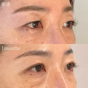 オーキッド美容クリニック東京御徒町 西浦 蘭子医師の症例