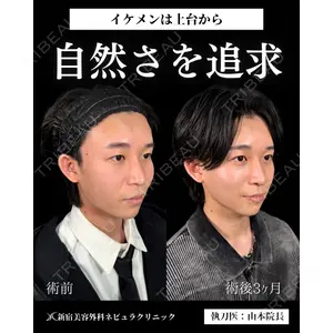 新宿美容外科ネビュラクリニック 山本 紘子医師の症例
