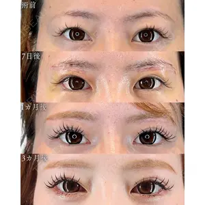 HAAB BEAUTY CLINIC 南青山本院（新院） 小平 佳典医師の症例