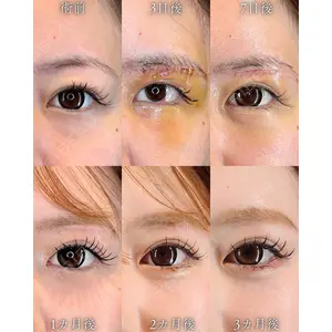 HAAB BEAUTY CLINIC 南青山本院（新院） 小平 佳典医師の症例