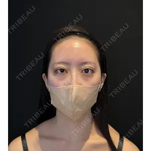 HAAB BEAUTY CLINIC 南青山本院（新院） 金子 雄医師の症例