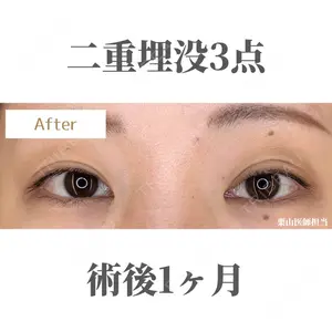 Belle Via Clinic 栗山 恵里花医師の症例