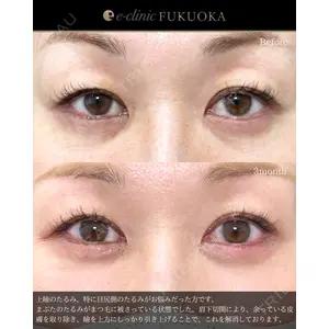 eクリニック 福岡院 伊藤 渉医師の症例