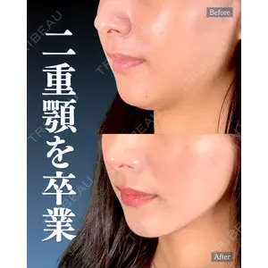 神戸美容外科 ネビュラクリニック 岩﨑 雅医師の症例