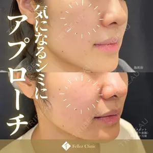 Fellez Clinic【フェルズクリニック】の症例