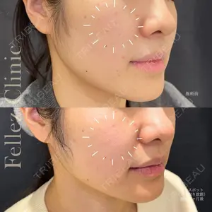 Fellez Clinic【フェルズクリニック】の症例