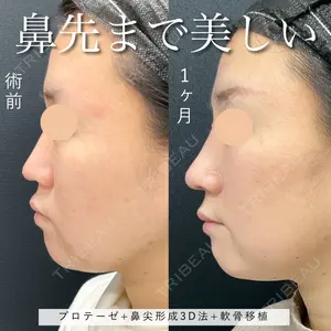 東京シンデレラ美容外科 池袋院 小出 真哉医師の症例