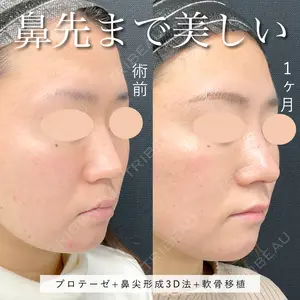 東京シンデレラ美容外科 池袋院 小出 真哉医師の症例