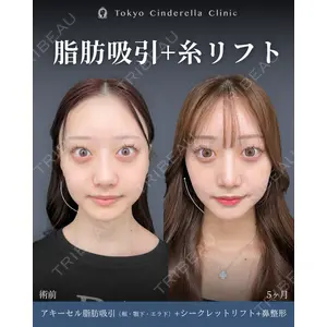 東京シンデレラ美容外科 新宿院 吉原 伯医師の症例
