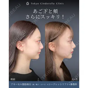東京シンデレラ美容外科 新宿院 吉原 伯医師の症例