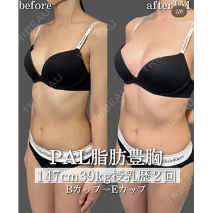 plume clinic 向山 綾子医師の症例