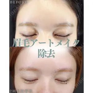 HAAB BEAUTY CLINIC 南青山本院（新院） 小平 佳典医師の症例