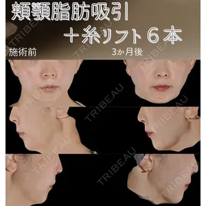 下北沢スキンクリニックの症例