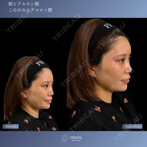 PRISM Beauty Clinic 新宿院 畑山 知輝医師の症例