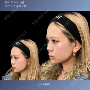 PRISM Beauty Clinic 新宿院 畑山 知輝医師の症例