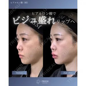 PRISM Beauty Clinic 新宿院 畑山 知輝医師の症例