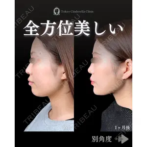 東京シンデレラ美容外科 池袋院 石井 達也医師の症例