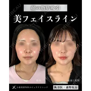 小倉美容外科ネビュラクリニック 浦野 正樹医師の症例