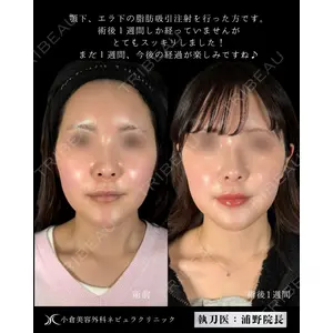 小倉美容外科ネビュラクリニック 浦野 正樹医師の症例