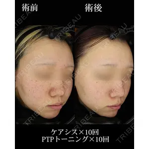 HAAB BEAUTY CLINIC 名古屋院の症例