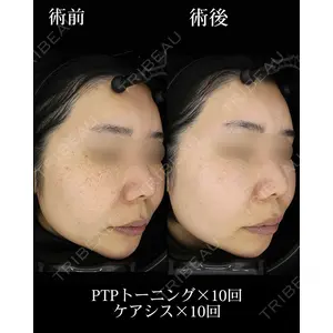 HAAB BEAUTY CLINIC 名古屋院の症例