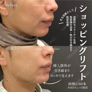 ロレシー美容クリニック 心斎橋駅前院 福留院長医師の症例