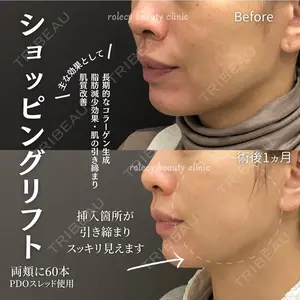 ロレシー美容クリニック 心斎橋駅前院 福留院長医師の症例