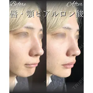 HAAB BEAUTY CLINIC 南青山本院（新院） 桂田 凛医師の症例