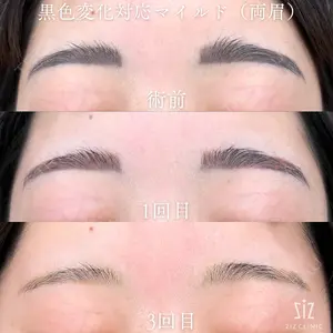 ziz CLINIC 村岡 史子医師の症例