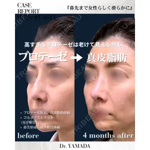 春山記念病院 山田 浩之医師の症例