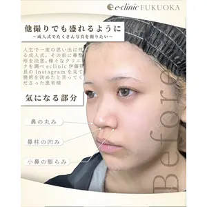eクリニック 福岡院 伊藤 渉医師の症例