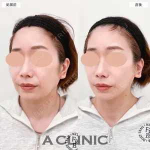 A CLINIC（エークリニック） 大阪院 田窪 賢志郎医師の症例