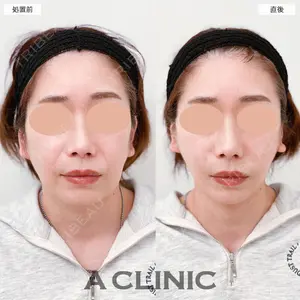 A CLINIC（エークリニック） 大阪院 田窪 賢志郎医師の症例