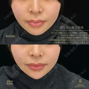 CROWN BEAUTY CLINIC 神山 豊医師の症例