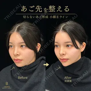CROWN BEAUTY CLINIC 神山 豊医師の症例