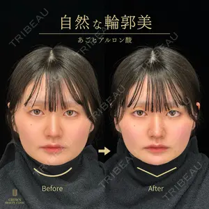 CROWN BEAUTY CLINIC 神山 豊医師の症例